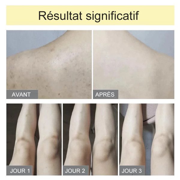 Eponge Exfoliante Ultra Douce Verkauf – Bild 3